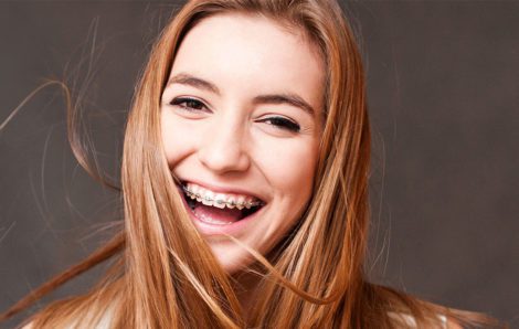 Traditional Braces to Correct Your Smile in The Kennewick Area