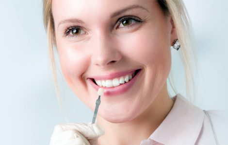 Dental Veneers for Cosmetic Dentistry
