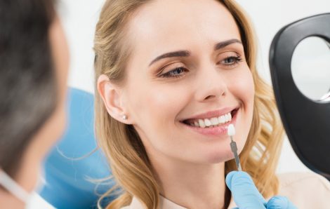 All You Need to Know About Dental Veneers